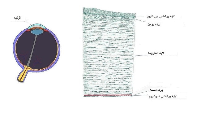 قرنیه چیست؟